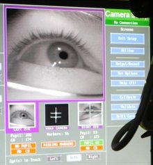 Eye tracker