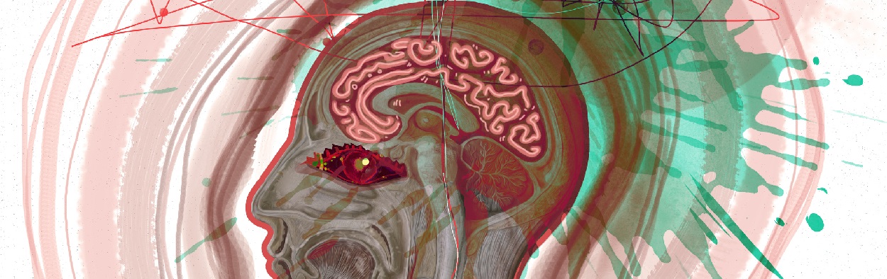 Mechanisms driving headache in idiopathic intracranial hypertension