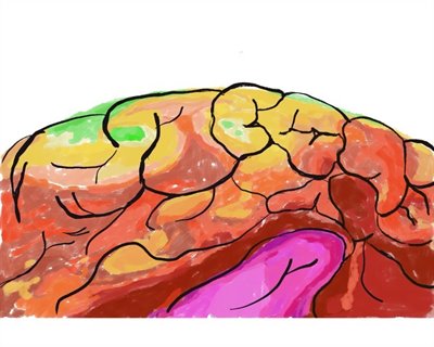 A vibrantly coloured graphic of the top of the brain with patches of red, pink, yellow, orange and green.