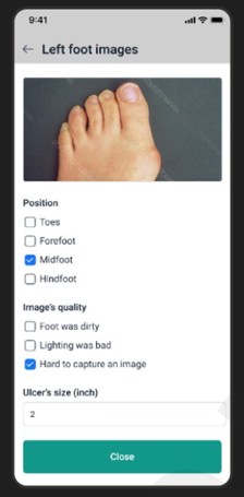 Phone screen with left foot captured with options to capture image quality