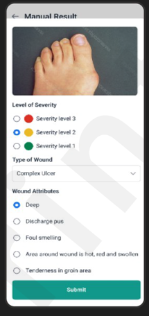 Phone screen with left foot captured and options to pick wound severity and attributions