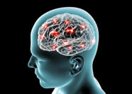 Research Aims To Find New Treatment For Secondary Brain Damage