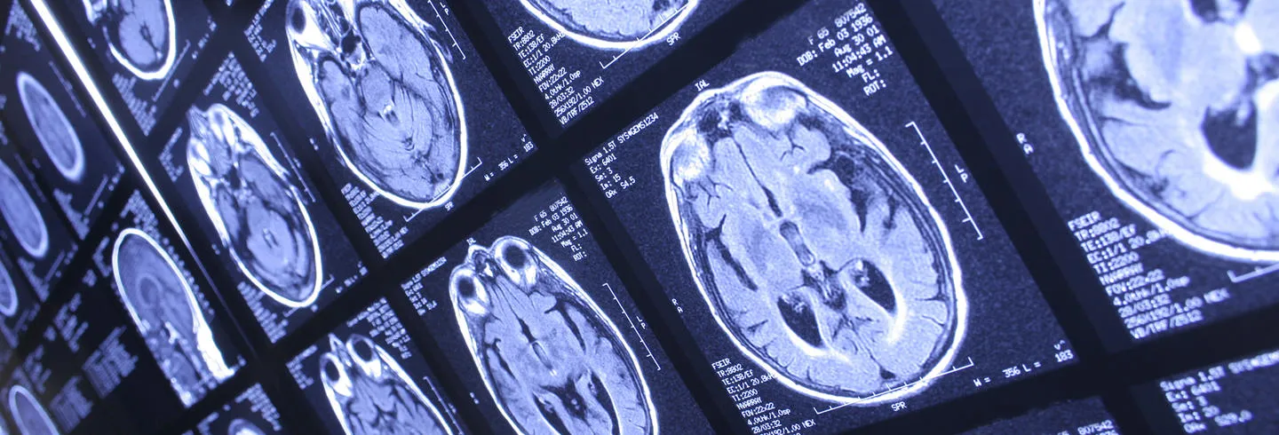 X ray of human brain