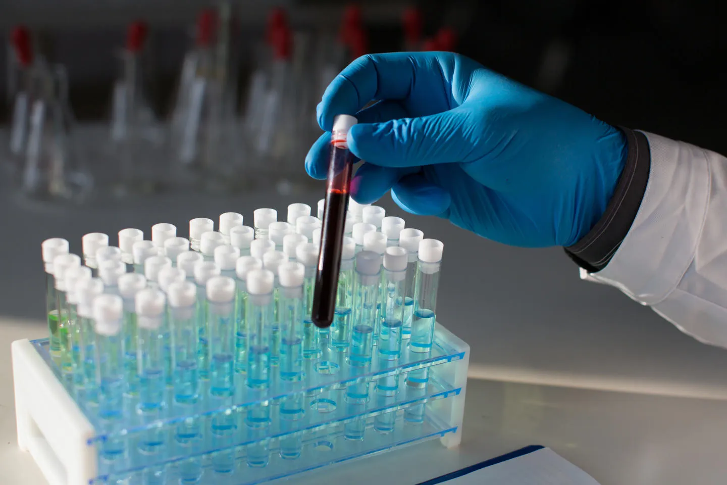 Close-up of a test tube with a sample of blood in the hands of a doctor in a laboratory.